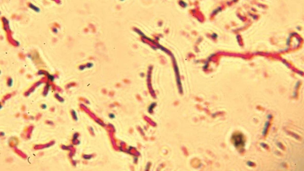 ScienceKlubben: Svampenes hemmelige verden.