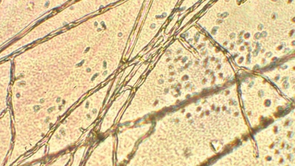 ScienceKlubben: Svampenes hemmelige verden.