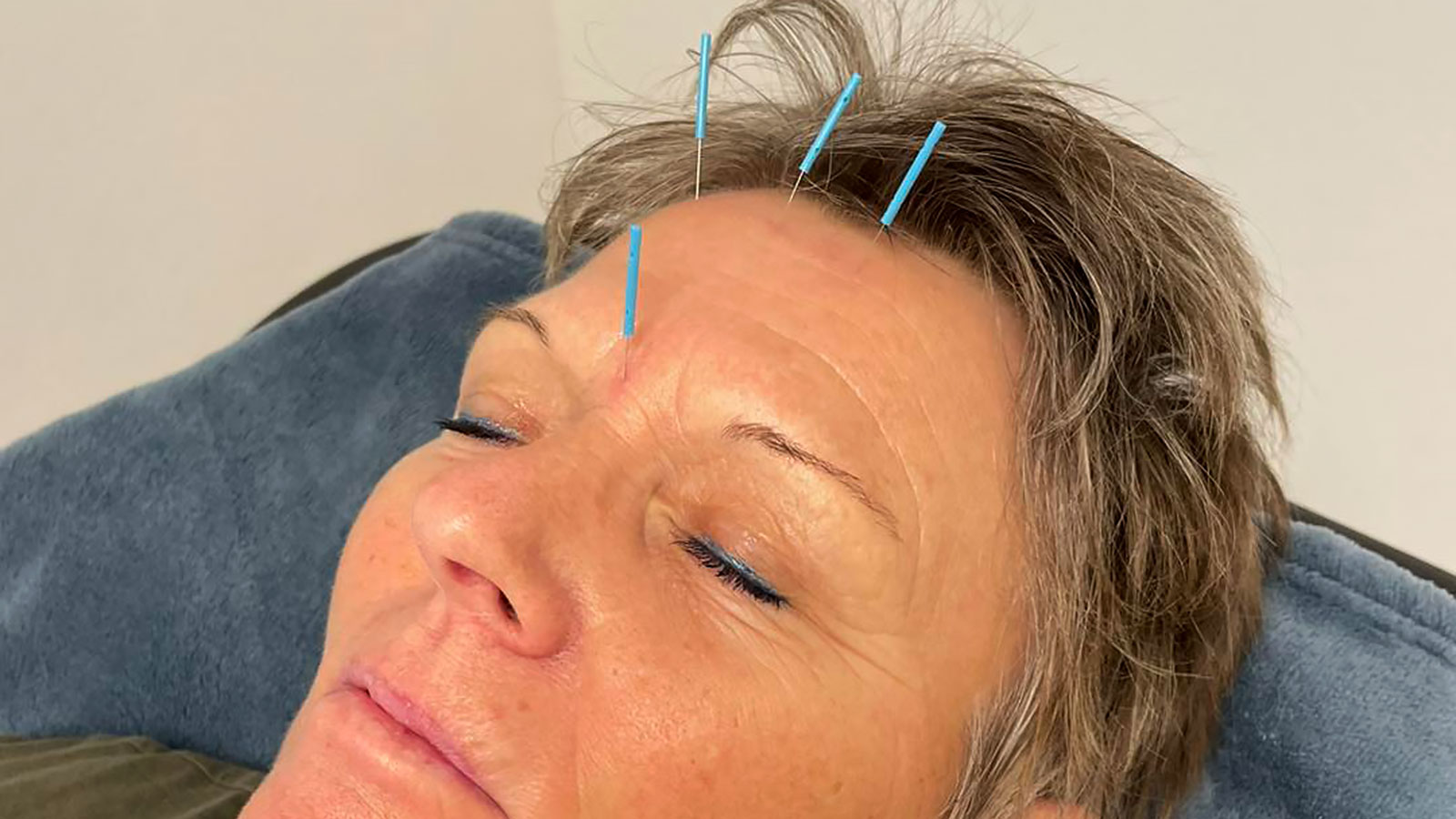 Lissau Moderne Akupunktur | Velvære | Krop og sind | Odsherred | Sjælland | Danmark